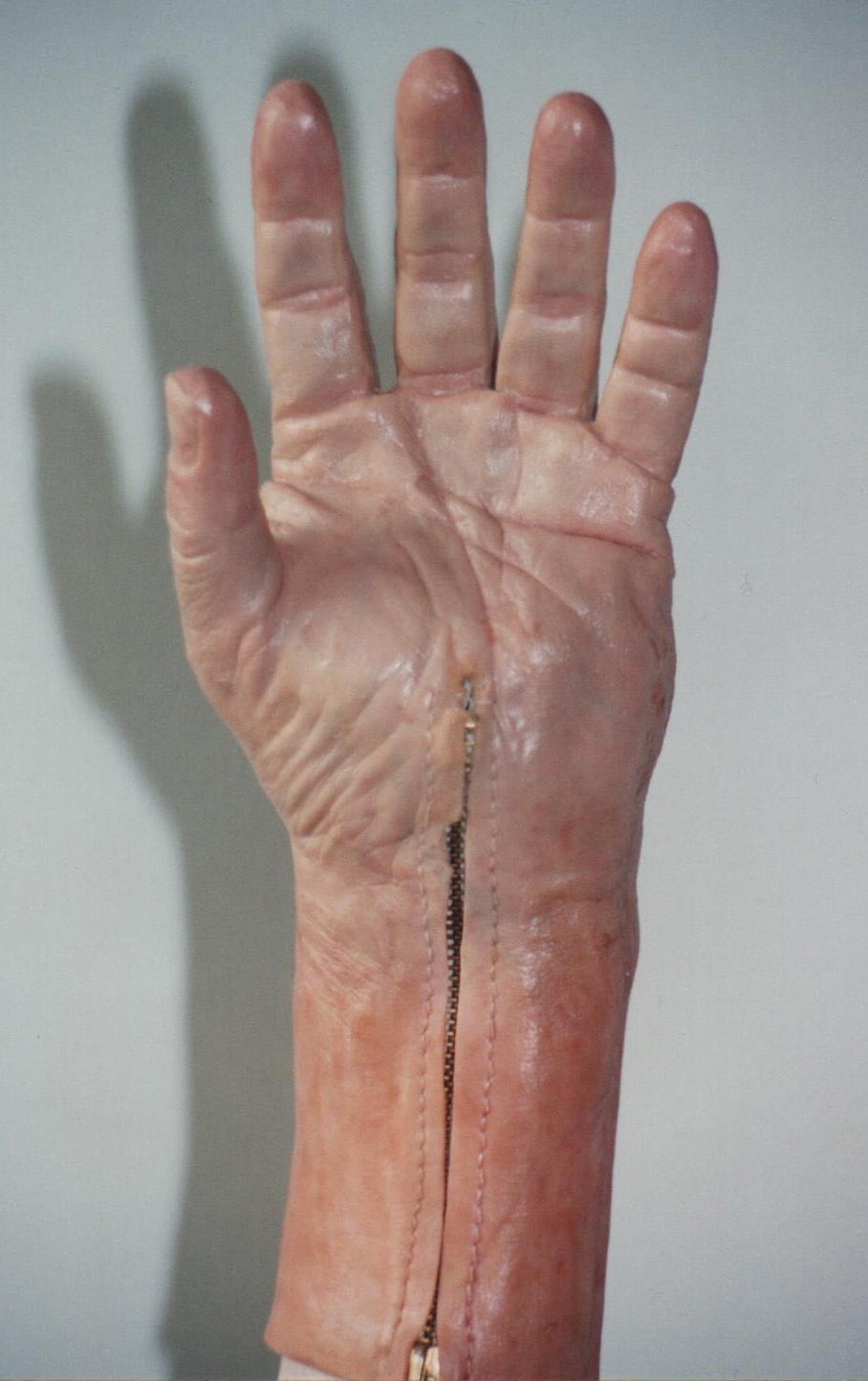 Prosthetic Hand 4
