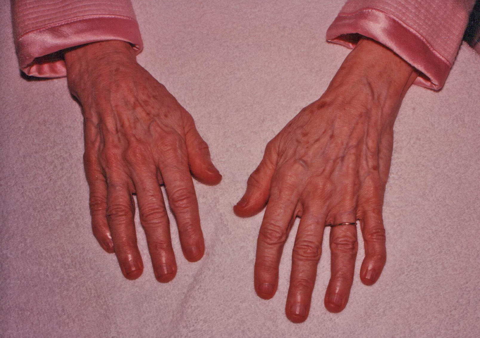 My grandmother's hands